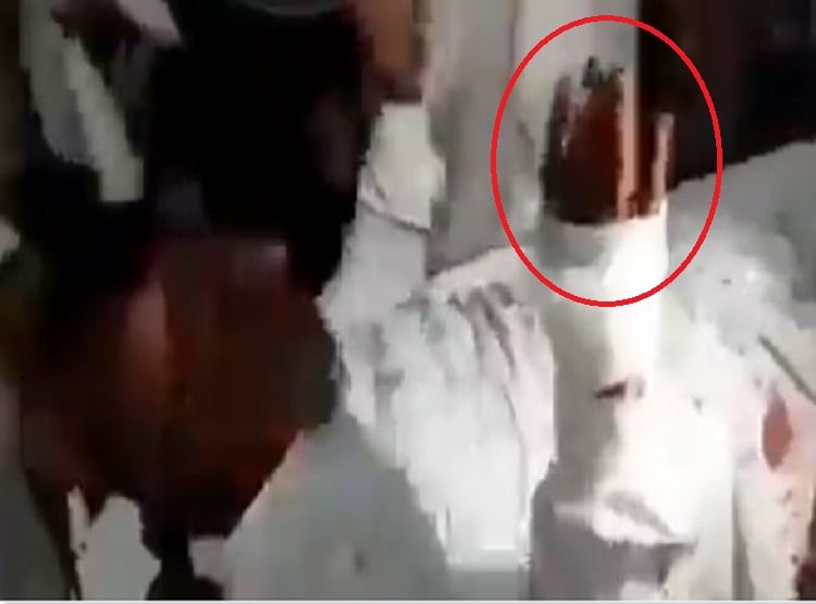 गोली लगने के बाद भी स्ट्रेचर पर बीड़ी पीता रहा शख्स, वीडियो वायरल