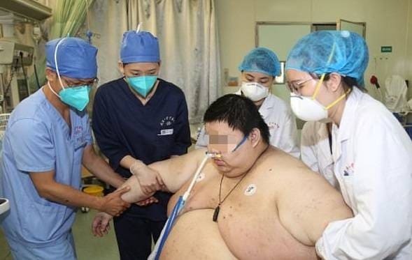 लॉकडाउन में 100 किलो बढ़ा वुहान के इस युवक का वजन, अब 250 के पार