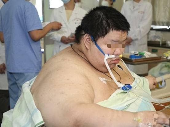 लॉकडाउन में 100 किलो बढ़ा वुहान के इस युवक का वजन, अब 250 के पार