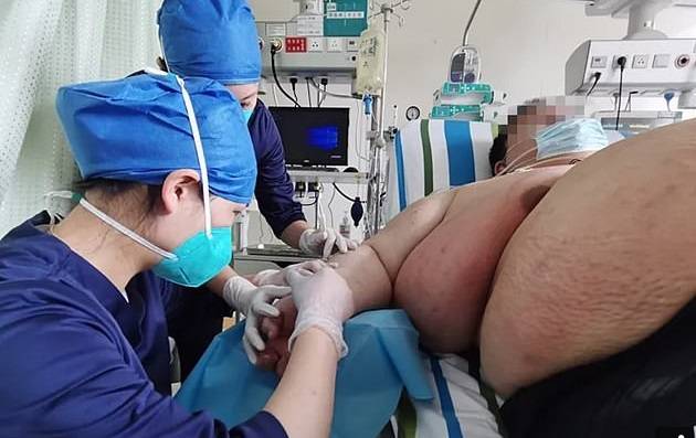 लॉकडाउन में 100 किलो बढ़ा वुहान के इस युवक का वजन, अब 250 के पार