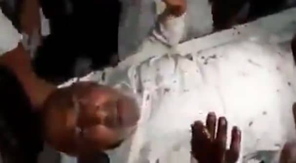 गोली लगने के बाद भी स्ट्रेचर पर बीड़ी पीता रहा शख्स, वीडियो वायरल