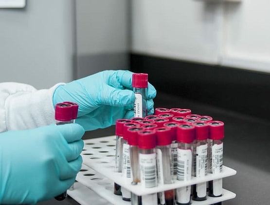 कोरोना के मामलों में उछाल सिर्फ टेस्टिंग बढ़ने का नतीजा नहीं: WHO