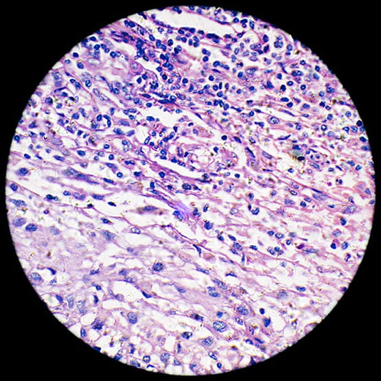 30 वर्षीय शादीशुदा महिला को इलाज के दौरान पता चला कि वह पुरुष है