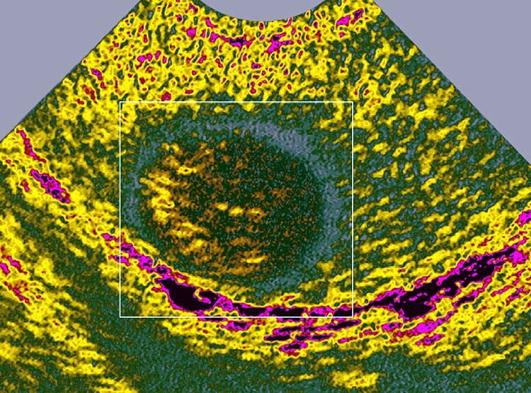 30 वर्षीय शादीशुदा महिला को इलाज के दौरान पता चला कि वह पुरुष है