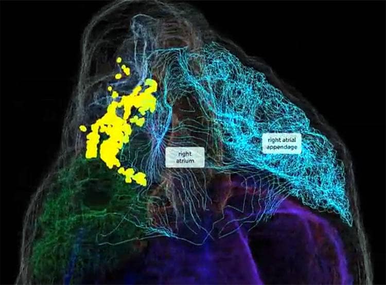 दिल के अंदर भी होता है दिमाग...वैज्ञानिकों ने बनाया 3डी नक्शा