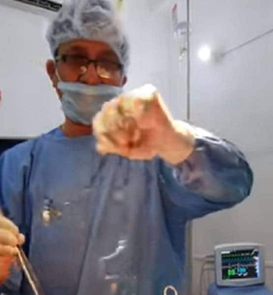 ऑपरेशन के दौरान पेट से निकला हेडफोन केबल, डॉक्टर भी रह गए हैरान