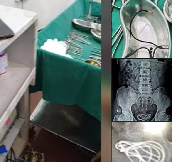ऑपरेशन के दौरान पेट से निकला हेडफोन केबल, डॉक्टर भी रह गए हैरान