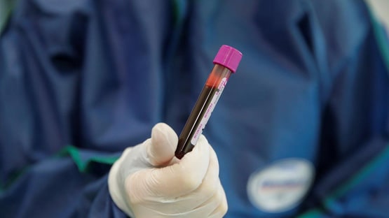 कोरोना से ठीक होने वाले पुरुषों में महिलाओं से अधिक होती है ये चीज