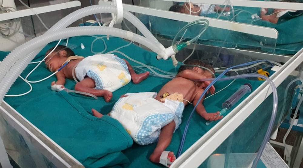 राजस्थान: महिला ने एक साथ चार बच्चों को दिया जन्म, सभी स्वस्थ