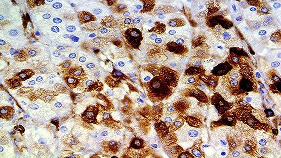 वैज्ञानिकों ने खोजा जवान रहने का राज, मानव शरीर में ही छिपा है ये फॉर्मूला