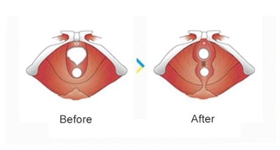 शादी के लिए ये मैट्रिमोनियल वेबसाइट दे रही वर्जिनिटी की गारंटी, उठे सवाल