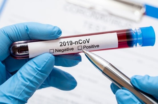 सिर्फ एक काम करने से एक या दो महीने में कंट्रोल हो सकता है कोरोना: CDC