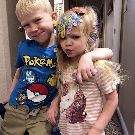 हीरो: 6 साल के बच्चे ने बहन को कुत्ते से बचाया, चेहरे पर आए 90 टांकें