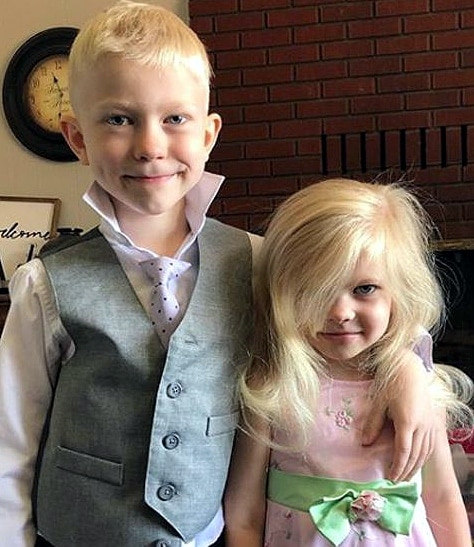 हीरो: 6 साल के बच्चे ने बहन को कुत्ते से बचाया, चेहरे पर आए 90 टांकें