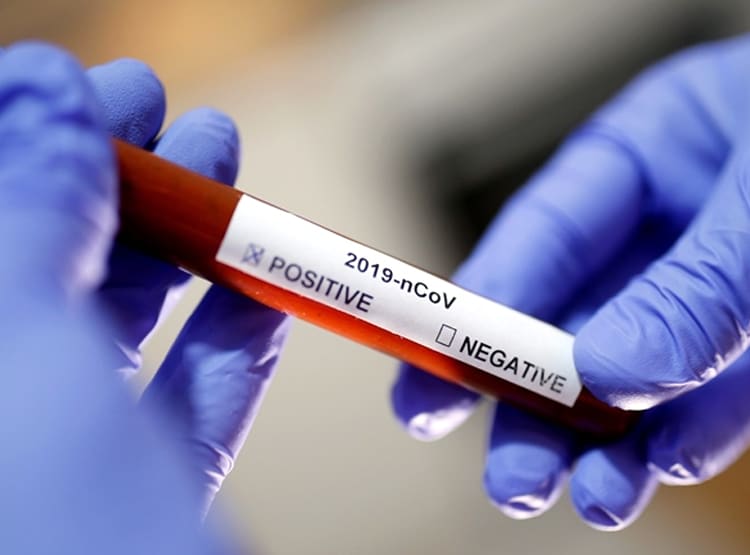 साजिश या खेल...बिना दवा के कोरोना मरीज जांच में पॉजिटिव से हो रहे निगेटिव