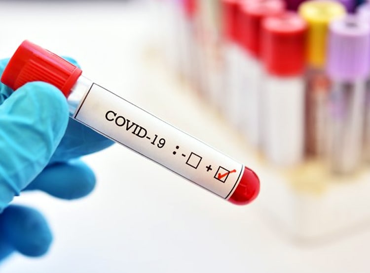 साजिश या खेल...बिना दवा के कोरोना मरीज जांच में पॉजिटिव से हो रहे निगेटिव