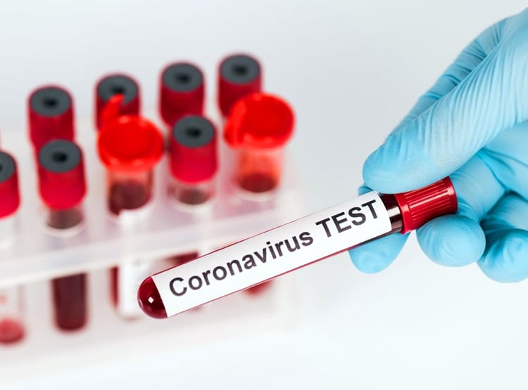 साजिश या खेल...बिना दवा के कोरोना मरीज जांच में पॉजिटिव से हो रहे निगेटिव