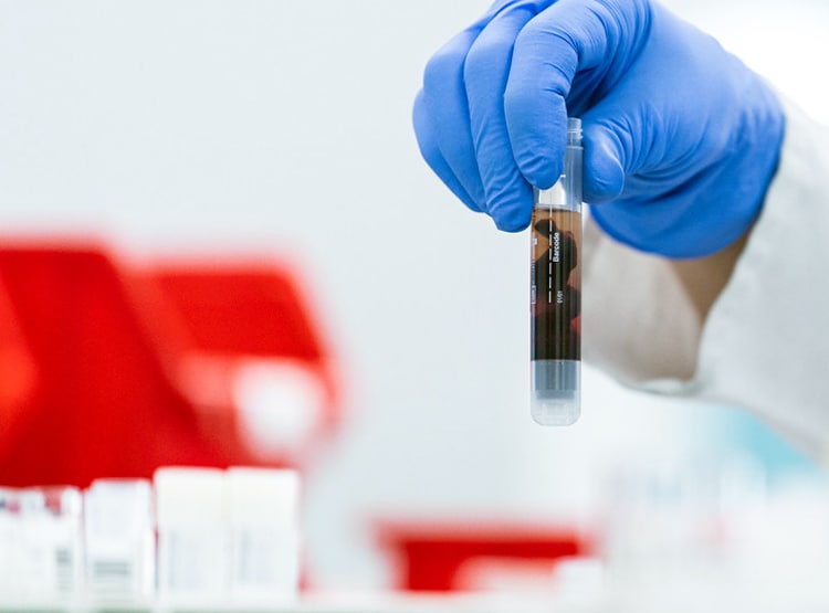 साजिश या खेल...बिना दवा के कोरोना मरीज जांच में पॉजिटिव से हो रहे निगेटिव