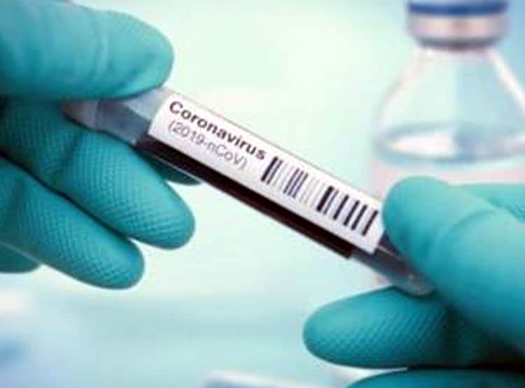 साजिश या खेल...बिना दवा के कोरोना मरीज जांच में पॉजिटिव से हो रहे निगेटिव