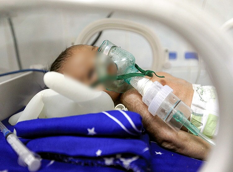 US-यूरोप के बाद भारत में आई ये खतरनाक बीमारी, सूरत में पहला केस