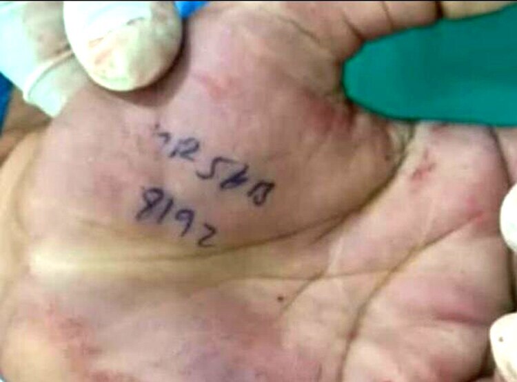 मरने से पहले हाथ पर लिखा था कातिल की गाड़ी का नंबर, ऐसे हुआ खुलासा