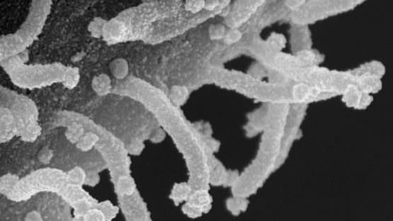 तस्वीर में दिखा- शरीर पर कितने भयावह तरीके से हमला करता है कोरोना