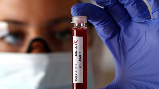 जान दांव पर लगाने को 30 हजार लोग तैयार, होना चाहते हैं कोरोना संक्रमित