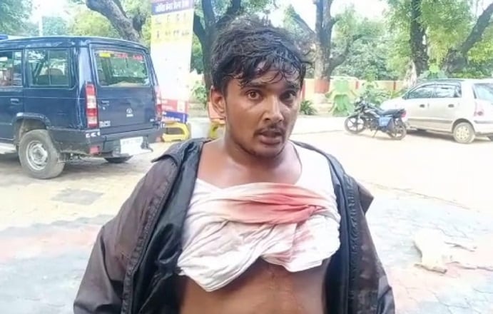 यूपी: सीने में धंसी थी गोली, थाने पहुंचे युवक को देख पुलिस हैरान