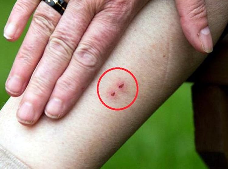 सांप के काटने पर घंटों चला झाड़-फूंक का ड्रामा, मंत्र पढ़ते ही अजीब हरकत