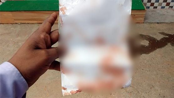 मरते वक्त प्रेमिका ने खून से लिखा प्रेमी का नाम, राज खुला तो सब रह गए दंग