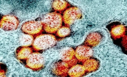 लोनार झील: रहस्य से उठा पर्दा, क्यों अचानक लाल हो गया था पानी