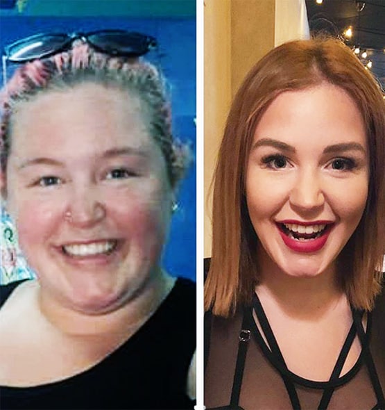 ब्रेकअप के बाद लड़की ने खुद को 76 KG किया कम, अब पहचानना मुश्किल