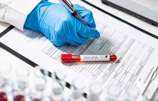 रूसी वैक्सीन की US ने उड़ाई खिल्ली, कहा- बंदर के लायक भी नहीं