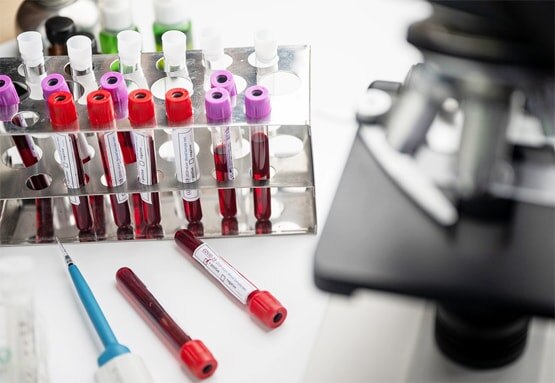 रूस बनाएगा कोरोना वैक्सीन की 20 करोड़ डोज, भारत ने भी दिखाई दिलचस्पी