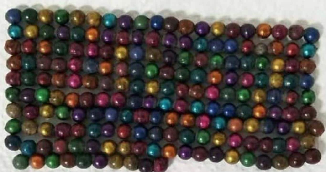 जब बच्ची के पेट में मिले 190 मैग्नेटिक बॉल, डॉक्टर भी रह गए दंग