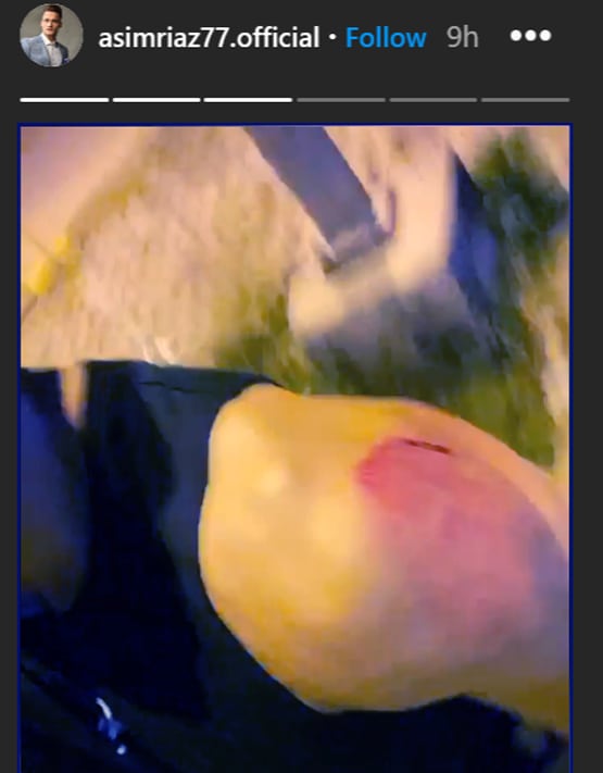 बिग बॉस कंटेस्टेंट आसिम रियाज पर बाइक सवार ने किया हमला, लगी चोट