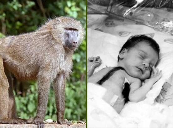 36 साल पहले बच्ची को लगाया गया था लंगूर का दिल, और फिर...