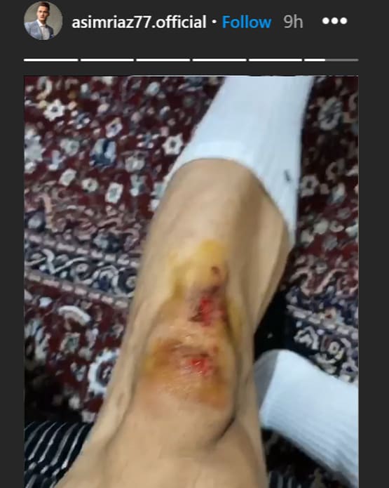 बिग बॉस कंटेस्टेंट आसिम रियाज पर बाइक सवार ने किया हमला, लगी चोट