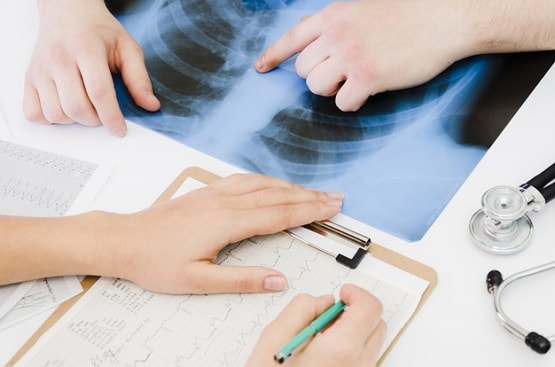 इन 6 कारणों से किसी को भी हो सकता है फेफड़ों का कैंसर, जानें लक्षण और बचाव