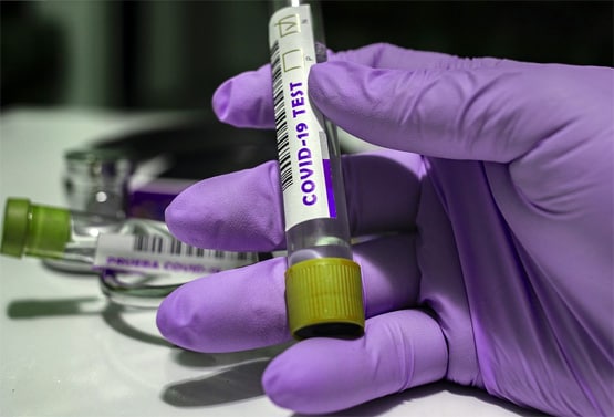 9 दिनों के बाद संक्रामक नहीं रह जाता कोरोना मरीज, स्टडी का दावा