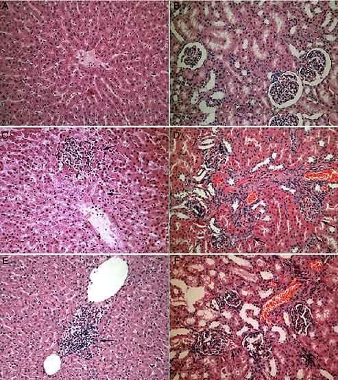 चीन में फैल रहा नया वायरस, 60 लोग बीमार, 7 लोगों की मौत