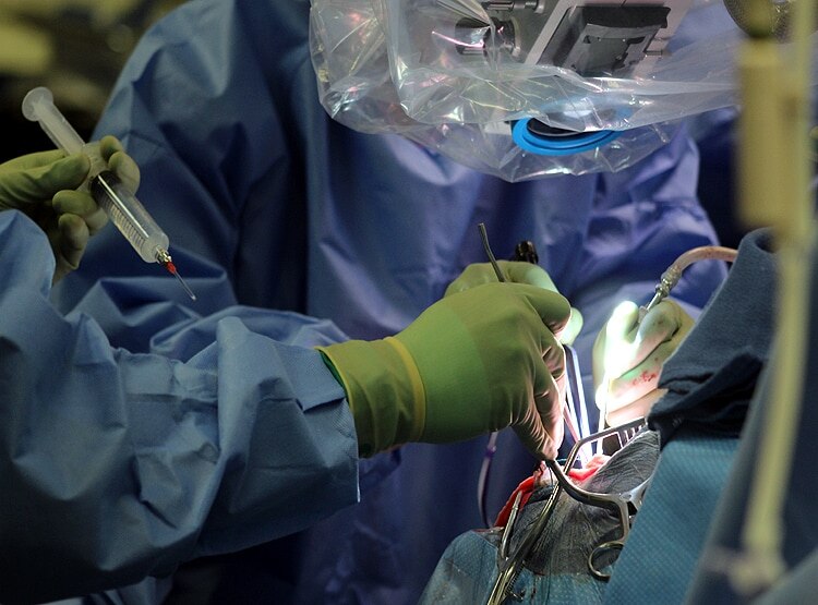 सालों से हाथ पर निजी अंग उगा रहा था शख्स, कोरोना ने रोकी सर्जरी पर मिली सफलता