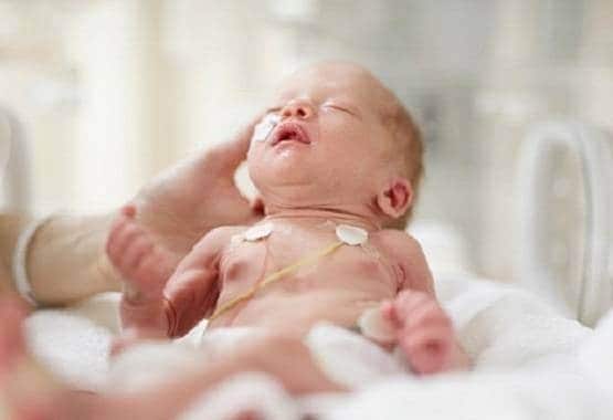 एक माह के बच्चे ने कोरोना को हराया, मां का दूध ऐसे बना हथियार