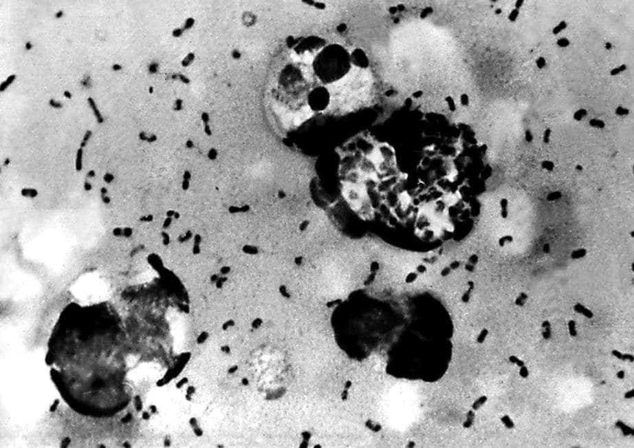 कोरोना के बाद इस बीमारी ने उड़ाई चीन की नींद, दो लोगों की मौत