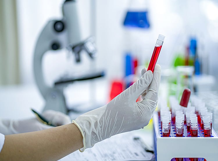 FDA की चेतावनी- कोरोना जांच हो सकती है गलत, लैब किट में गड़बड़ी