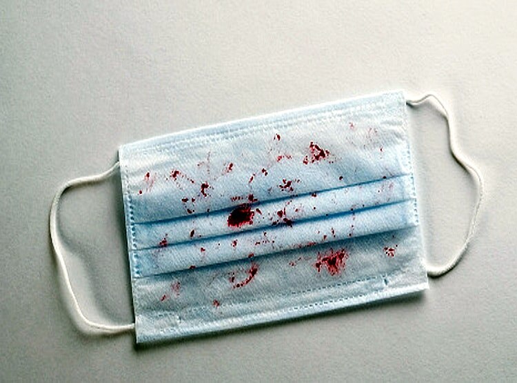 कोरोना से खतरनाक है ये बीमारी, हर साल सबसे ज्यादा लोगों की मौत इसी से