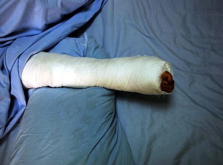 18वीं मंजिल से गिरा 4 साल का बच्चा, पर जाको राखे साइयां, मार सके न कोय