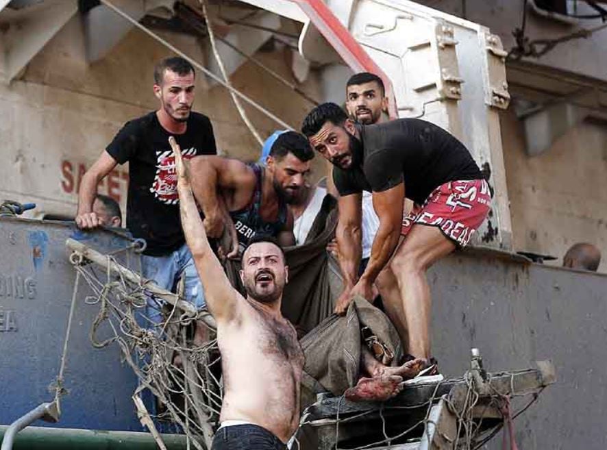 स्कूटी पर घायल को लेकर अस्पताल पहुंचा युवक, देखें बेरूत धमाके का मंजर