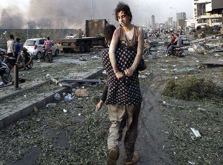 एटम बम जैसे धमाके से उजड़ा बेरूत, देखिए पहले और अब की तस्वीरें