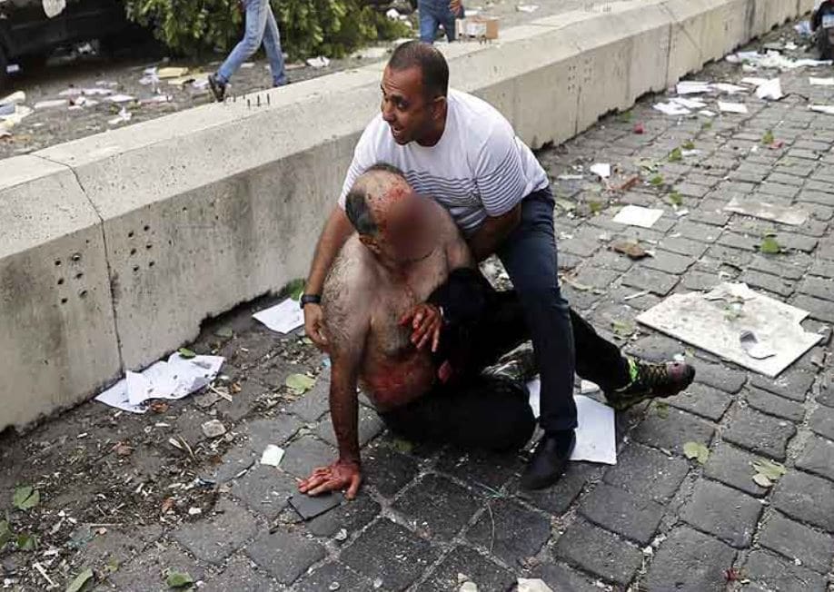 स्कूटी पर घायल को लेकर अस्पताल पहुंचा युवक, देखें बेरूत धमाके का मंजर